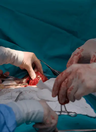 Breast conservation surgery breast cancer care breast tumor removal lumpectomy surgery breast cancer surgery