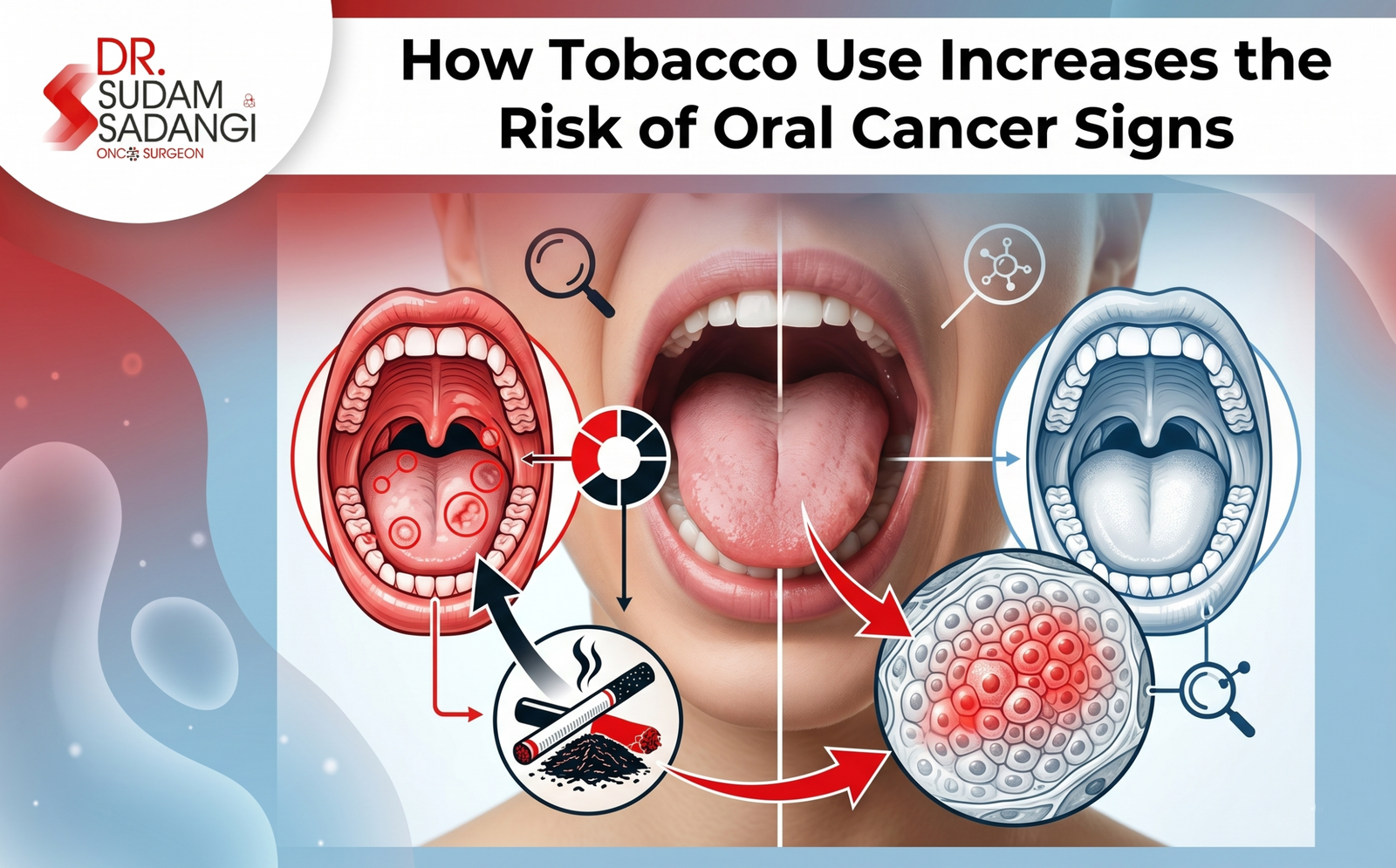 Banner showing the title 'How Tobacco Use Increases the Risk of Oral Cancer Signs' with a medical illustration of the mouth and tobacco-related imagery used to explain risks.