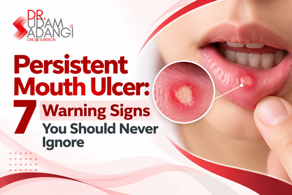 Persistent Mouth Ulcer Warning Signs